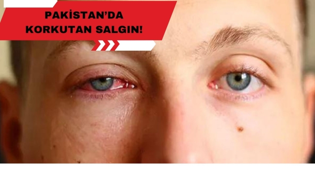 PAKİSTAN'DA KORKUTAN SALGIN