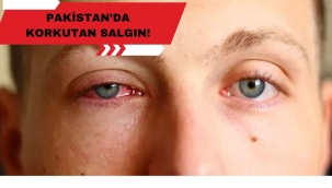 PAKİSTAN'DA KORKUTAN SALGIN